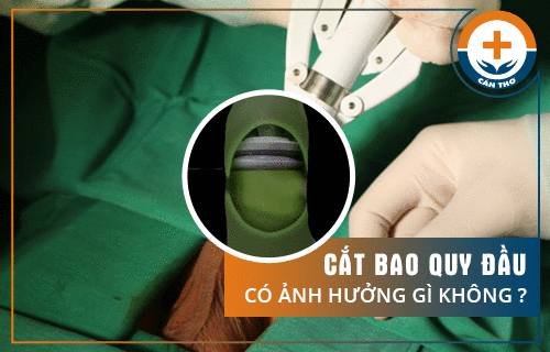 Cắt Bao Quy Đầu Có Ảnh Hưởng Gì Không?