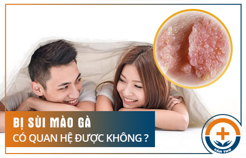 Bị Sùi Mào Gà Có Được Quan Hệ Tình Dục Không?