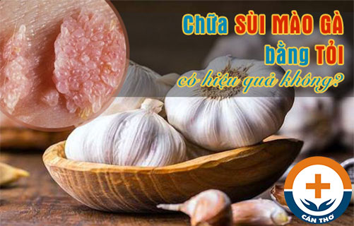 Chữa sùi mào gà bằng tỏi có hiệu quả không?