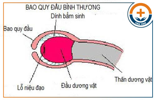 Dính bao quy đầu là bệnh gì? Có nguy hiểm không?