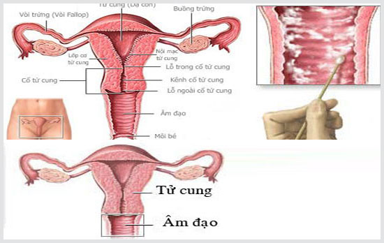 Biến chứng của bệnh viêm âm đạo