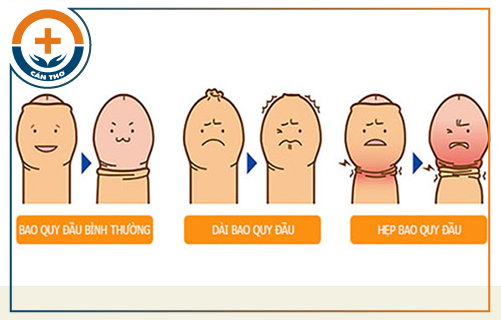 Chữa bệnh bao quy đầu ở cơ sở nào uy tín?