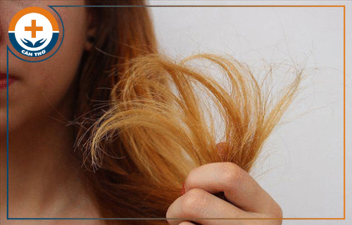 Những nguyên nhân gây ra chứng rụng tóc là gì?
