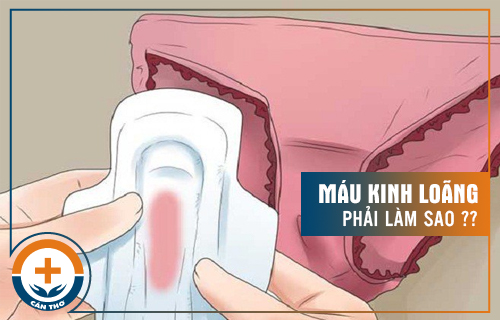 Máu Kinh Loãng – Nguyên Nhân Và Cách Điều Trị Hiệu Quả