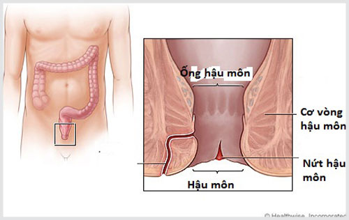 Những nguy hại khi bị nứt kẽ hậu môn