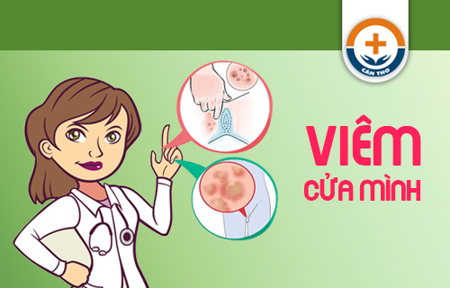 Viêm Cửa Mình Là Bệnh Gì? Nguyên Nhân Và Cách Trị Hiệu Quả