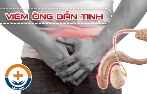 Viêm ống dẫn tinh là bệnh gì? Nguyên nhân, triệu chứng và cách trị hiệu quả